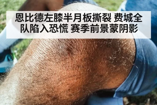 恩比德左膝半月板撕裂 费城全队陷入恐慌 赛季前景蒙阴影
